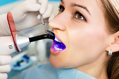 Cass Street Dental Office | Veneers, Dental Fillings and Pediatric Dentistry