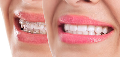 Cass Street Dental Office | Periodontal Treatment, Dental Bridges and Crowns  amp  Caps