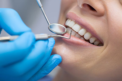 Cass Street Dental Office | Teeth Whitening, Implant Dentistry and Preventative Program