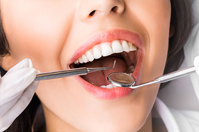 Cass Street Dental Office | Periodontal Treatment, Extractions and Dentures