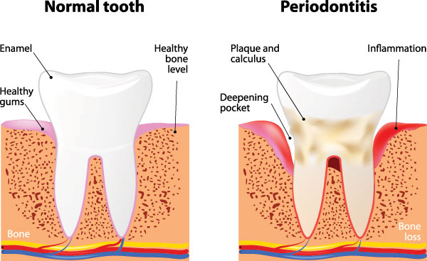 Cass Street Dental Office | Periodontal Treatment, Implant Dentistry and Dental Cleanings