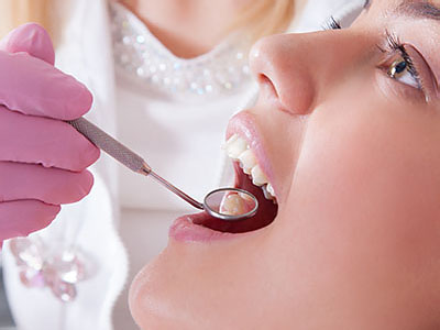 Cass Street Dental Office | Extractions, Emergency Treatment and Crowns  amp  Caps